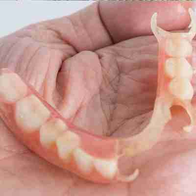 the palm of a human holding partial dentures