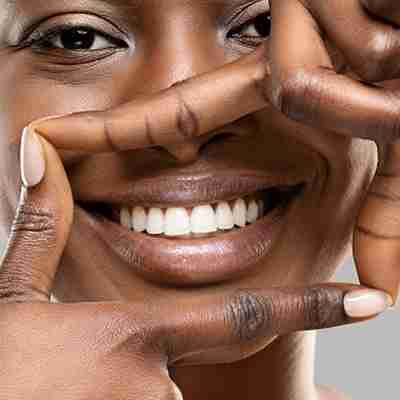 Teeth Whitening an african american woman making a box around her smile to signify teeth whitening